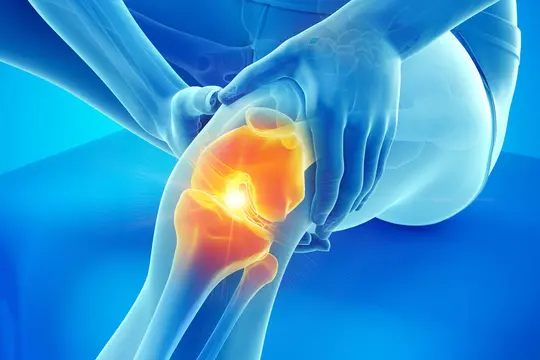 photo of knee pain